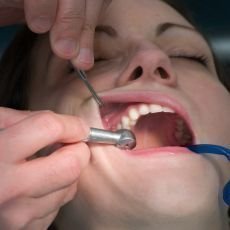 Musím podstoupit ošetření u dentální hygienistky na přání zubaře?