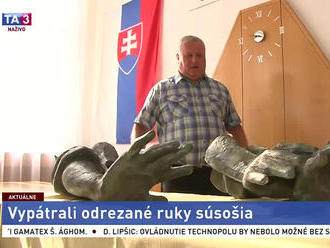 Odrezané ruky sú v správnych rukách. Polícia našla časti súsošia