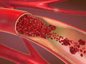 Národný ústav srdcových a cievnych chorôb chce kúpiť špeciálny zdravotnícky materiál