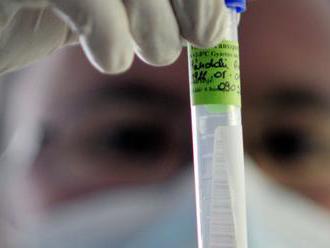 Do nemocnice v Žiline prišli dvaja muži s podozrením na koronavírus