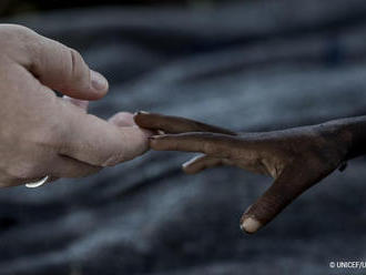 UNICEF bojuje proti podvýžive aj vďaka pomoci zo Slovenska