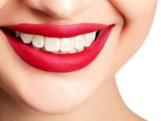 Dentálna hygiena a bielenie zubov pre žiarivý a zdravý úsmev