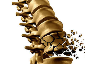 Osteoporóza - hrozba pre pohybový aparát