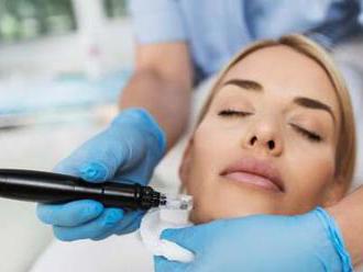 Microneedling – mezoterapia s DermaPen