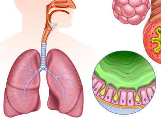 Problém s dychom? Môže ísť o vážne ochorenie