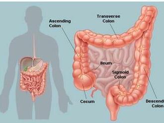 Nezhubné nádory hrubého čreva a riziko malígneho zvrhnutia.