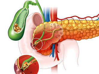 Pankreas: Spoznajte ho a starajte sa oň