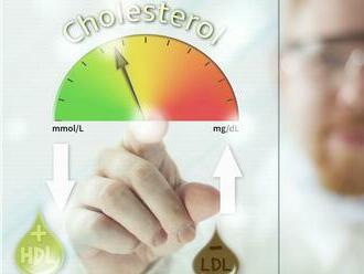 Cholesterol si nevygooglite. Treba ho zmerať