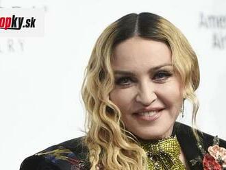 Fanúšikovia v ŠOKU: Madonna   zmenená na NEPOZNANIE... Plastiky si vypýtali svoju DAŇ!