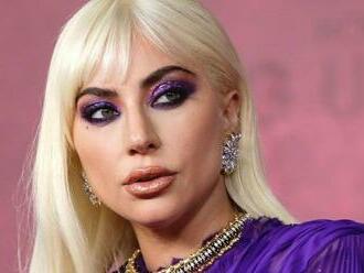 Spravodlivosť po AMERICKY: Ani nevedel, že buldočkovia patria Lady Gaga a vyfasoval 21 rokov!