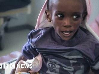 Ethiopia civil war: The boy named ‘Wealthy’ who weighs half what he should