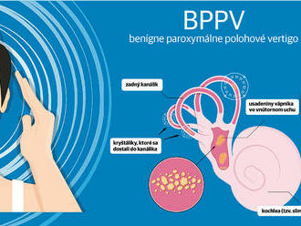 Vertigo: Vnútorné ucho vie rozkrútiť náš svet