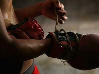 South African boxer dies after bleeding on the brain