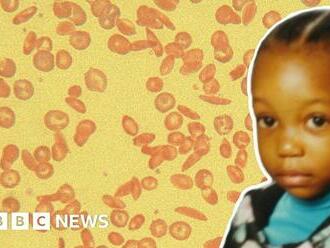 Exploring the stigma of sickle cell anaemia