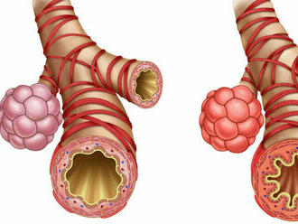 Zle sa vám dýcha? Môže to byť astma
