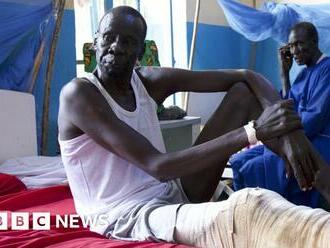 What UK aid cut means for one South Sudan hospital