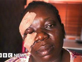 Nigeria election: 'I was performing my civic duty' says injured voter