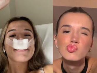 Influencerka vo videu ŠOKUJE: Išla som na plastiku, aby sa moje DETI narodili s peknými nosmi