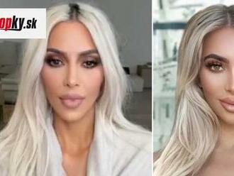 Jedna nestačí? Svet má ĎALŠIU Kim Kardashian: Za plastiky vysolila 30-tisíc... TOTO je výsledok!