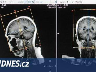 Umělá inteligence se díky magnetické rezonanci naučila číst myšlenky