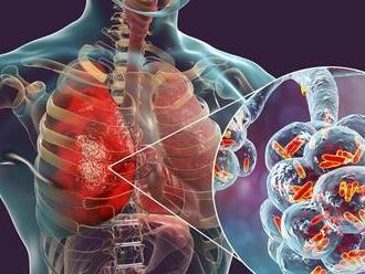 Epidémia v Čechách neutícha: Máme sa obávať čierneho kašľa?