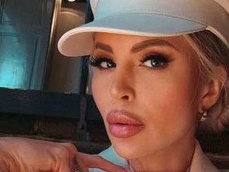 FOTO Lela Ceterová si dala opäť NAPICHAŤ pery: Drsná KRITIKA a nepochopiteľný argument blondínky