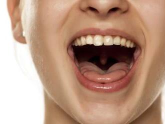 Pociťujete sucho v ústach? Zbystrite: 5 NEBEZPEČNÝCH chorôb, ktoré za tým môžu byť!
