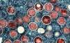 JAR hlási prvú obeť ochorenia mpox, testovanie odhalilo päť nakazených