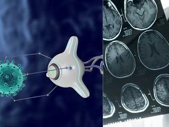 Vážne ochorenie nám môžu liečiť NANOROBOTY: Vedci ich vstrekli do mozgu a... Wau!